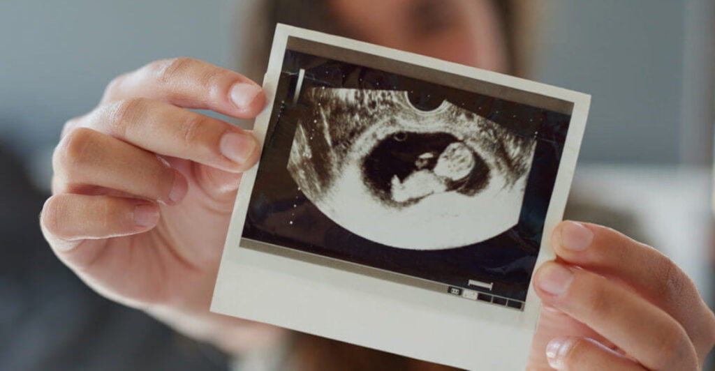 2D OB-GYN Ultrasound - by FemmHealth v1.0. All Rights Reserved. · Email ...